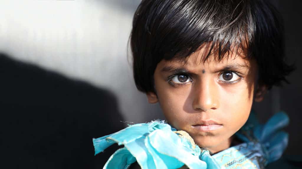 A girl with cataract looking straight in the camera