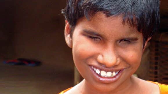 A visually impaired girl smiles.